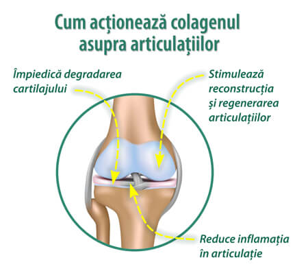 Medicina regenerativa a cartilajului | juniorswim.ro