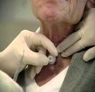 Recuperează-ți capacitatea de a respira cu Clarfon