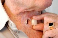 Clarfon, prietenul de nădejde al pacienților laringectomizați