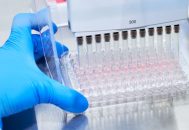 Primul test de sânge minim invaziv care ajută la excluderea bolii Alzheimer, disponibil în România