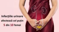 Infecțiile urinare afectează cel puțin 5 din 10 femei Care este tratamentul