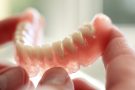 Inlocuirea Dintilor Pierduti: O Abordare Cuprinzatoare in Protetica Dentara