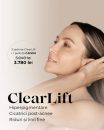 Ai observat pete pe ten, cicatrici post-acnee sau riduri fine? Clearlift, laserul fără downtime, îți corectează toate problemele!